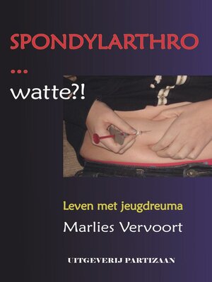 cover image of Spondylarthro... watte?!